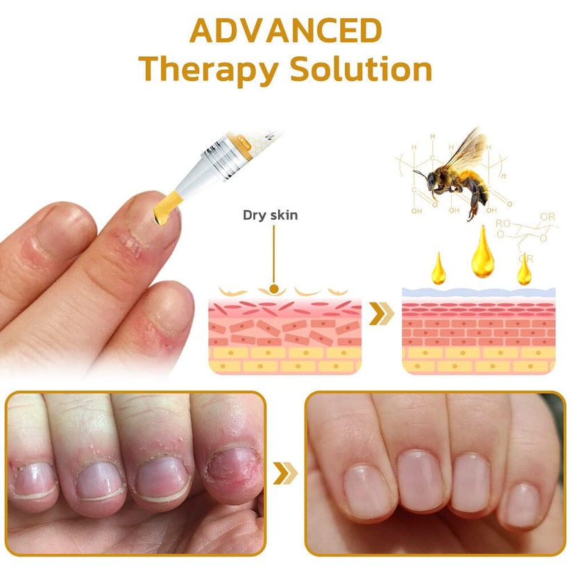 BeeVenom® Gel con Veneno de Abeja  para crecimiento de uñas en 7 dias