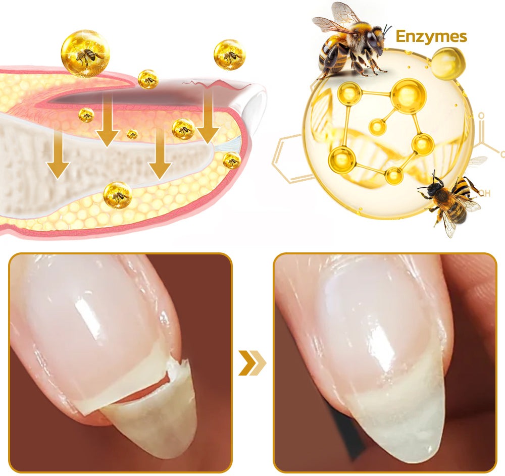 BeeVenom® Gel con Veneno de Abeja  para crecimiento de uñas en 7 dias